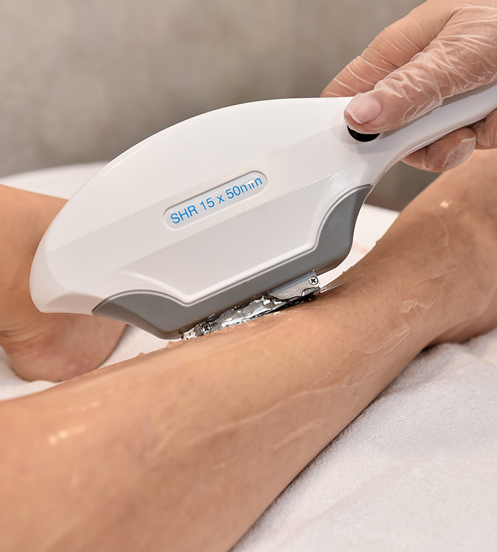 Buz Başlıklı Lazer Epilasyon